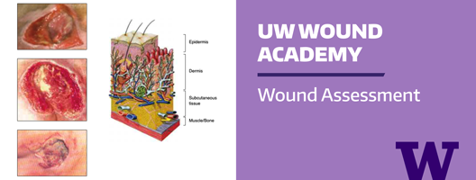 Image for Wound Academy Wound Assessment course.